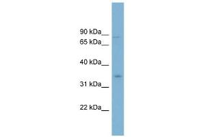 GPD2 antibody used at 1 ug/ml to detect target protein. (GPD2 抗体)