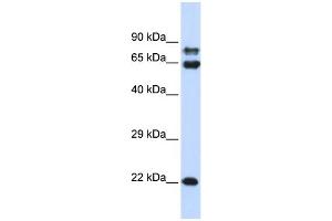 WB Suggested Anti-PPP2R1A Antibody Titration: 0. (PPP2R1A 抗体  (N-Term))