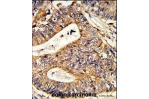 Immunohistochemistry (Paraffin-embedded Sections) (IHC (p)) image for anti-Calreticulin (CALR) (AA 277-305) antibody (ABIN390885)