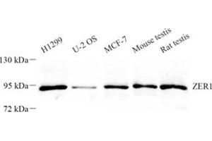 Western blot analysis of ZER1 (ABIN7076289) at dilution of 1: 500 (ZER1 抗体)