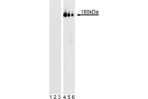 Western Blotting (WB) image for anti-Platelet Derived Growth Factor Receptor beta (PDGFRB) (pTyr857) antibody (ABIN967592) (PDGFRB 抗体  (pTyr857))