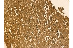 TDP43 Mouse Monoclonal Antibody at 1/100 staining mouse brain tissue by IHC-P.