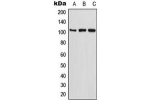 Western blot analysis of ETAA1 expression in U2OS (A), MCF7 (B), PC12 (C) whole cell lysates. (ETAA1 抗体  (N-Term))