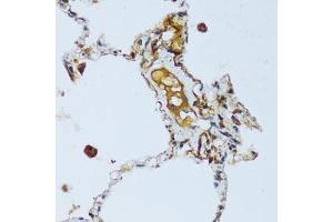Immunohistochemistry (IHC) image for anti-Complement Component 1, Q Subcomponent, C Chain (C1QC) (AA 50-150) antibody (ABIN7266475)
