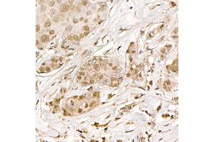 Immunohistochemistry (IHC) image for anti-Catenin (Cadherin-Associated Protein), beta 1, 88kDa (CTNNB1) antibody (ABIN7266137)