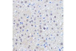 Immunohistochemistry of paraffin-embedded rat liver using RBM39 antibody (ABIN7270085) at dilution of 1:100 (40x lens). (RBM39 抗体  (C-Term))