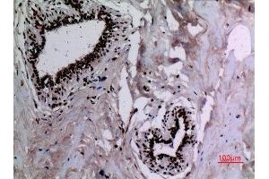 Immunohistochemistry (IHC) image for anti-Heat Shock Protein 90 (HSP90) (acLys284), (acLys292) antibody (ABIN3181886)