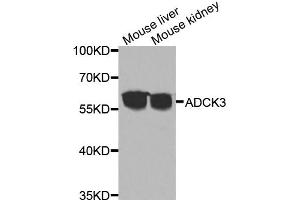 Western blot analysis of extracts of various cell lines, using ADCK3 antibody (ABIN5975514) at 1/1000 dilution. (COQ8A 抗体)
