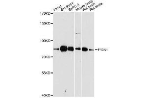 Western blot analysis of extracts of various cell lines, using F13A1 antibody. (F13A1 抗体  (AA 600-732))