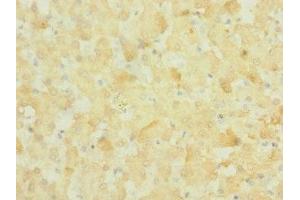 Immunohistochemistry of paraffin-embedded human liver tissue using ABIN7161008 at dilution of 1:100 (NOX3 抗体  (AA 223-395))