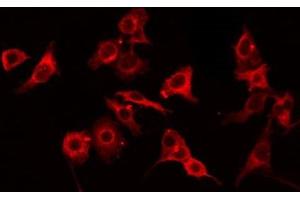 ABIN6275062 staining HT29 by IF/ICC. (GNPAT 抗体  (Internal Region))