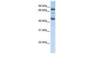 Image no. 1 for anti-Growth Arrest-Specific 2 Like 1 (GAS2L1) (AA 434-483) antibody (ABIN6738814)