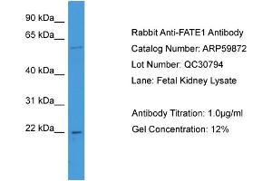 WB Suggested Anti-FATE1  Antibody Titration: 0. (FATE1 抗体  (N-Term))