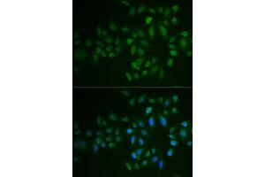 Immunofluorescence analysis of U2OS cells using MYLK3 antibody (ABIN6129615, ABIN6144266, ABIN6144267 and ABIN6222364). (MYLK3 抗体  (AA 1-240))