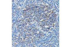Immunohistochemistry of paraffin-embedded Mouse spleen using Alpha-tubulin (ubiquitous) chain antibody (ABIN7271033) at dilution of 1:50 (40x lens). (TUBA1B 抗体  (AA 1-451))