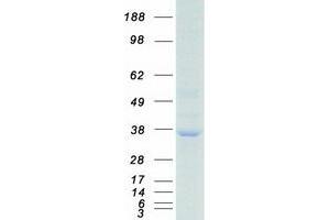 Western Blotting (WB) image for Replication Protein A2, 32kDa (RPA2) protein (Myc-DYKDDDDK Tag) (ABIN2731116)