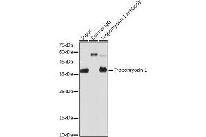 Immunoprecipitation (IP) image for anti-Tropomyosin 1 (Alpha) (TPM1) antibody (ABIN7271013)