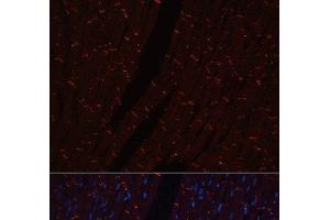 Immunofluorescence analysis of Rat heart using N-Cadherin Polyclonal Antibody (N-Cadherin 抗体)