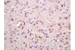 Formalin-fixed and paraffin embedded rat brain labeled with Rabbit Anti HSP10/CPN10 Polyclonal Antibody, Unconjugated (ABIN721885) at 1:200 followed by conjugation to the secondary antibody and DAB staining (HSPE1 抗体  (AA 51-102))