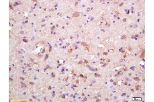 Formalin-fixed and paraffin embedded rat brain labeled with Rabbit Anti HSP10/CPN10 Polyclonal Antibody, Unconjugated (ABIN721885) at 1:200 followed by conjugation to the secondary antibody and DAB staining