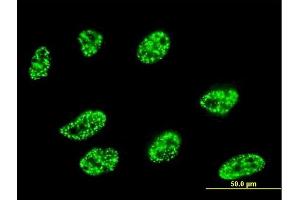 Immunofluorescence of monoclonal antibody to DLL1 on HeLa cell. (DLL1 抗体  (AA 18-109))