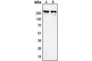 Western blot analysis of NCOR1 expression in K562 (A), HeLa (B) whole cell lysates. (NCOR1 抗体  (N-Term))