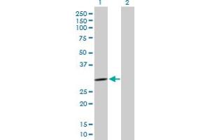 Western Blotting (WB) image for anti-Proprotein Convertase Subtilisin/kexin Type 1 Inhibitor (PCSK1N) (AA 1-260) antibody (ABIN525979)
