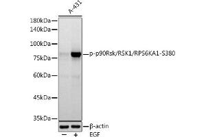 Western blot analysis of extracts of A-431 cells, using Phospho-p90Rsk/RSK1/RPS6K-S380 antibody (ABIN7270036) at 1:1000 dilution. (RPS6KA1 抗体  (pSer380))
