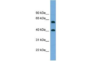 Western Blotting (WB) image for anti-Telomeric Repeat Binding Factor 2, Interacting Protein (TERF2IP) (Middle Region) antibody (ABIN2787164)