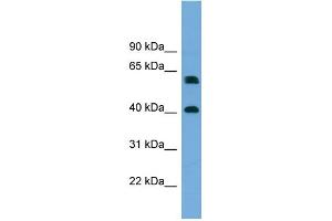 WB Suggested Anti-TERF2IP Antibody Titration: 0. (RAP1 抗体  (Middle Region))