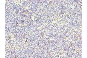 Immunohistochemistry of paraffin-embedded human thymus tissue using ABIN7169003 at dilution of 1:100 (STK38L 抗体  (AA 212-464))