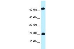 Image no. 1 for anti-Zinc Finger Protein 580 (ZNF580) (AA 58-107) antibody (ABIN6748023) (ZNF580 抗体  (AA 58-107))