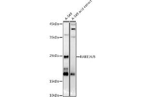 Western blot analysis of extracts of A-549 cells, using RA/B antibody (ABIN7269790) at 1:1000 dilution. (RAB11A 抗体)