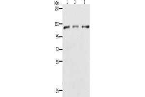 Western Blotting (WB) image for anti-Poly (ADP-Ribose) Polymerase 1 (PARP1) antibody (ABIN2432195) (PARP1 抗体)