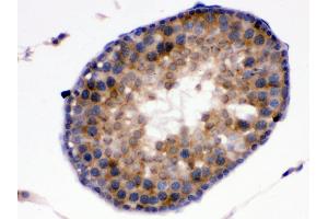 Anti-Kallikrein 5 antibody, IHC(P) IHC(P): Rat Testis Tissue (Kallikrein 5 抗体  (C-Term))