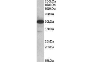Western Blotting (WB) image for anti-Thioredoxin Domain Containing 5 (Endoplasmic Reticulum) (TXNDC5) (Internal Region) antibody (ABIN2464475) (TXNDC5 抗体  (Internal Region))