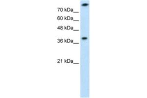 Western Blotting (WB) image for anti-Thiosulfate Sulfurtransferase (Rhodanese) (TST) antibody (ABIN2462532) (TST 抗体)