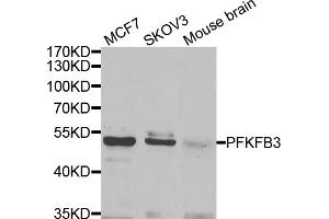 Western blot analysis of extracts of various cell lines, using PFKFB3 antibody (ABIN5974173) at 1/1000 dilution. (PFKFB3 抗体)