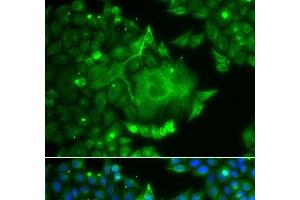 Immunofluorescence analysis of A549 cells using CACNG4 Polyclonal Antibody (CACNG4 抗体)