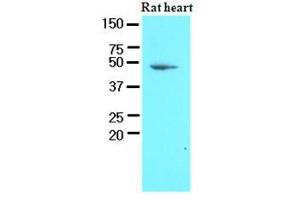 Western Blotting (WB) image for anti-3-phosphoinositide Dependent Protein Kinase-1 (PDPK1) (AA 29-436) antibody (ABIN400866) (PDPK1 抗体  (AA 29-436))