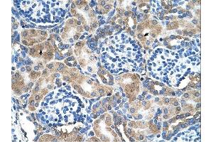 SOD1 antibody was used for immunohistochemistry at a concentration of 4-8 ug/ml. (SOD1 抗体  (N-Term))