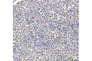 IHC analysis of ARID1A using anti-ARID1A antibody (ABIN7602567).