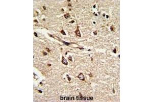 Immunohistochemistry (IHC) image for anti-Protein Disulfide Isomerase Family A, Member 6 (PDIA6) antibody (ABIN3002737) (PDIA6 抗体)