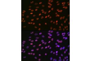 Immunofluorescence analysis of C6 cells using SMC1 Rabbit mAb (ABIN7270614) at dilution of 1:100 (40x lens). (SMC1A 抗体)