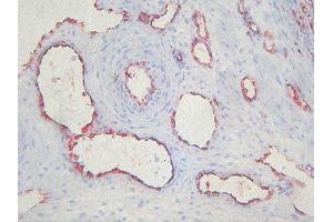 Immunohistochemistry (IHC) image for anti-Endothelial Cells antibody (ABIN781798) (Endothelial Cells 抗体)