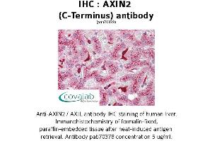 Image no. 1 for anti-Axin 2 (AXIN2) antibody (ABIN1732157) (AXIN2 抗体)
