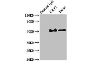 Immunoprecipitating KRT7 in HepG2 whole cell lysate Lane 1: Rabbit control IgG (1 μg) instead of ABIN7157444 in HepG2 whole cell lysate. (Cytokeratin 7 抗体  (AA 2-469))