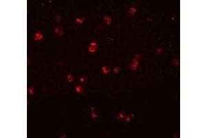 Immunofluorescencent staining of Jurkat cells with NLRC3 polyclonal antibody  at 20 ug/mL. (NLRC3 抗体  (Internal Region))