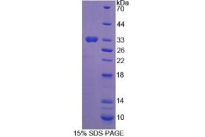 SDS-PAGE analysis of Mouse PGAM2 Protein. (PGAM2 蛋白)