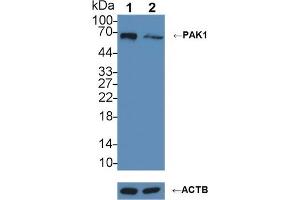 anti-P21-Activated Kinase 1 (PAK1) (AA 252-501) antibody